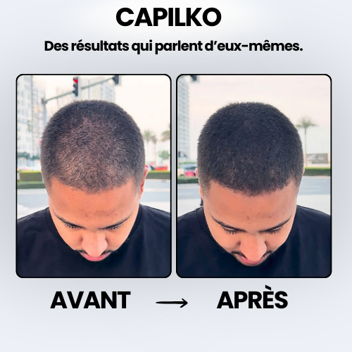 Poudre de camouflage capillaire CAPILKO
