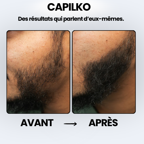 Poudre de camouflage capillaire CAPILKO